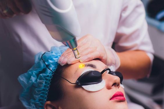 Formation Speed Détatouage & Carbon Peel